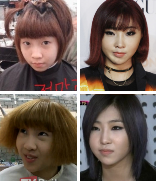 10 Shocking Photos Of Korean Celebrity Plastic Surgery Amped Asia