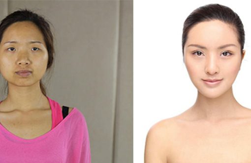 Chinese Plastic Surgery