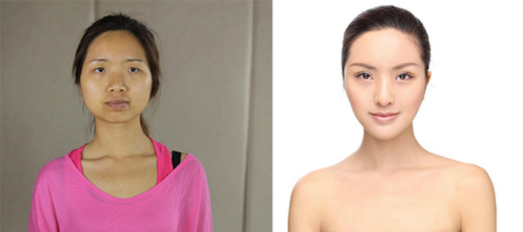 Chinese Plastic Surgery